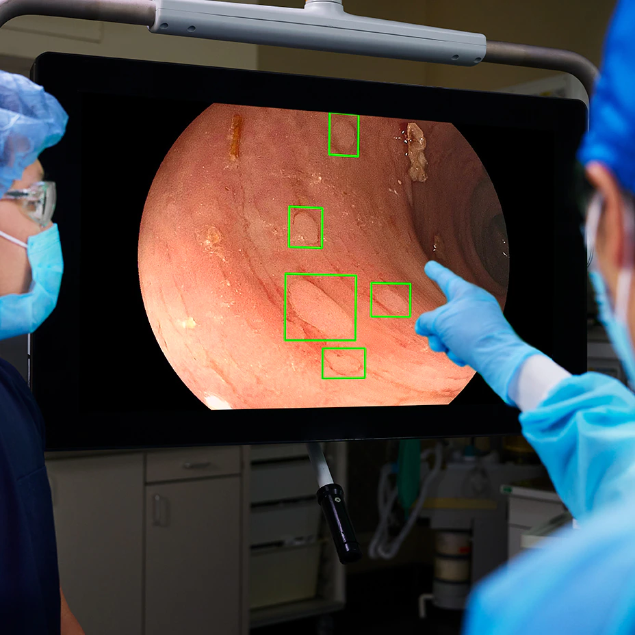 gi genius monitor in use